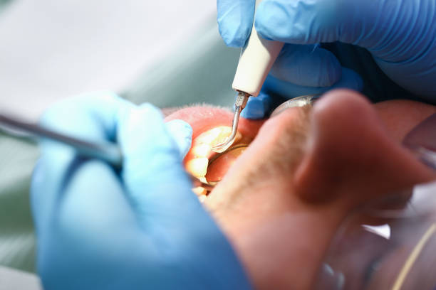 Best Walk-In Emergency Dentist in Frederickson, WA