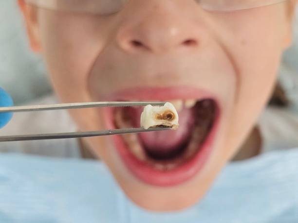Best Emergency Dental Care for Trauma or Injury in Frederickson, WA